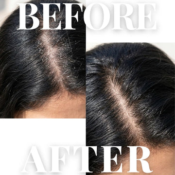 Shikekai Scalp Scrub